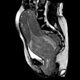 Illustration for article titled Bonus: Stills Of The MRI Live Birth